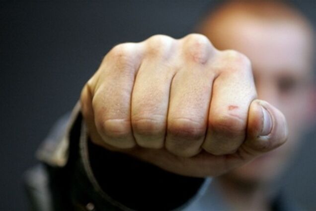 Прокуратура расследует избиение журналиста