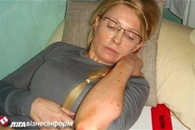 Избиение Тимошенко: обнародованы фото гематом