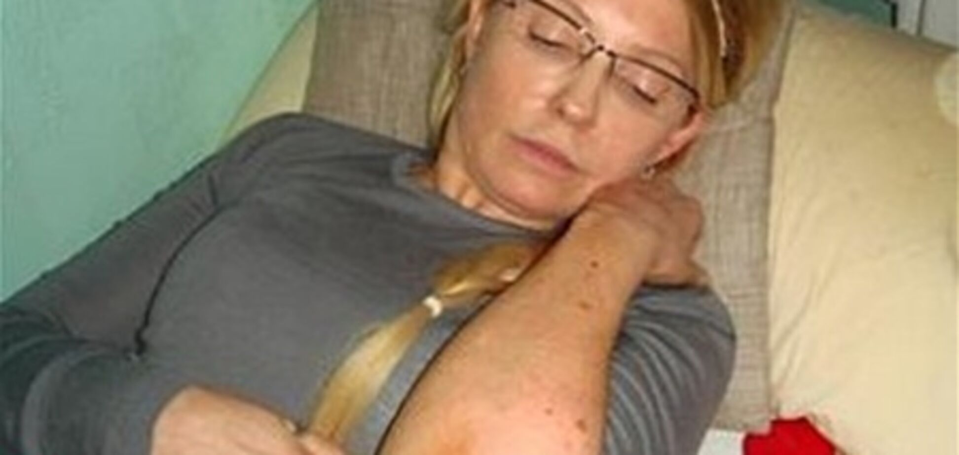 Избиение Тимошенко: обнародованы фото гематом