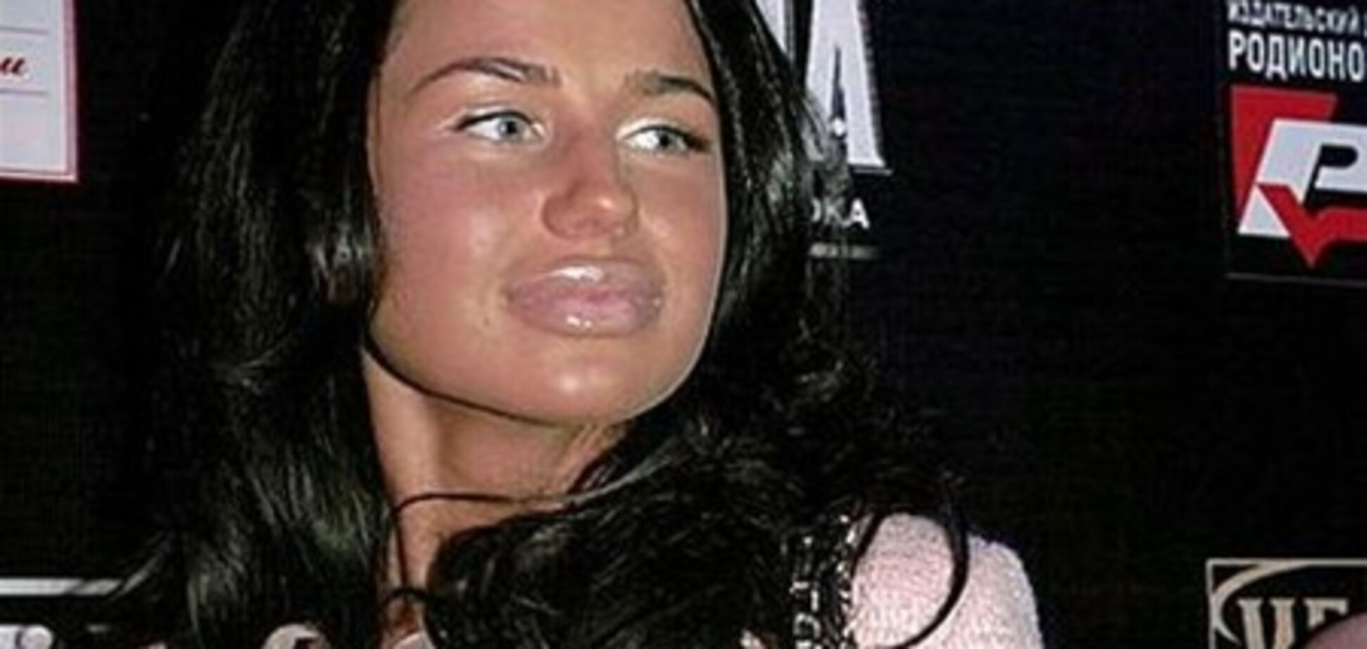 Алексе из-за пластики больно говорить