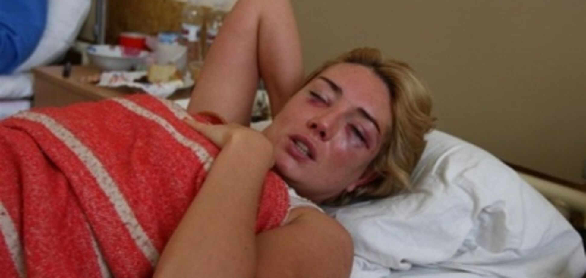 Розинской отбили почку, есть подозрение на перелом