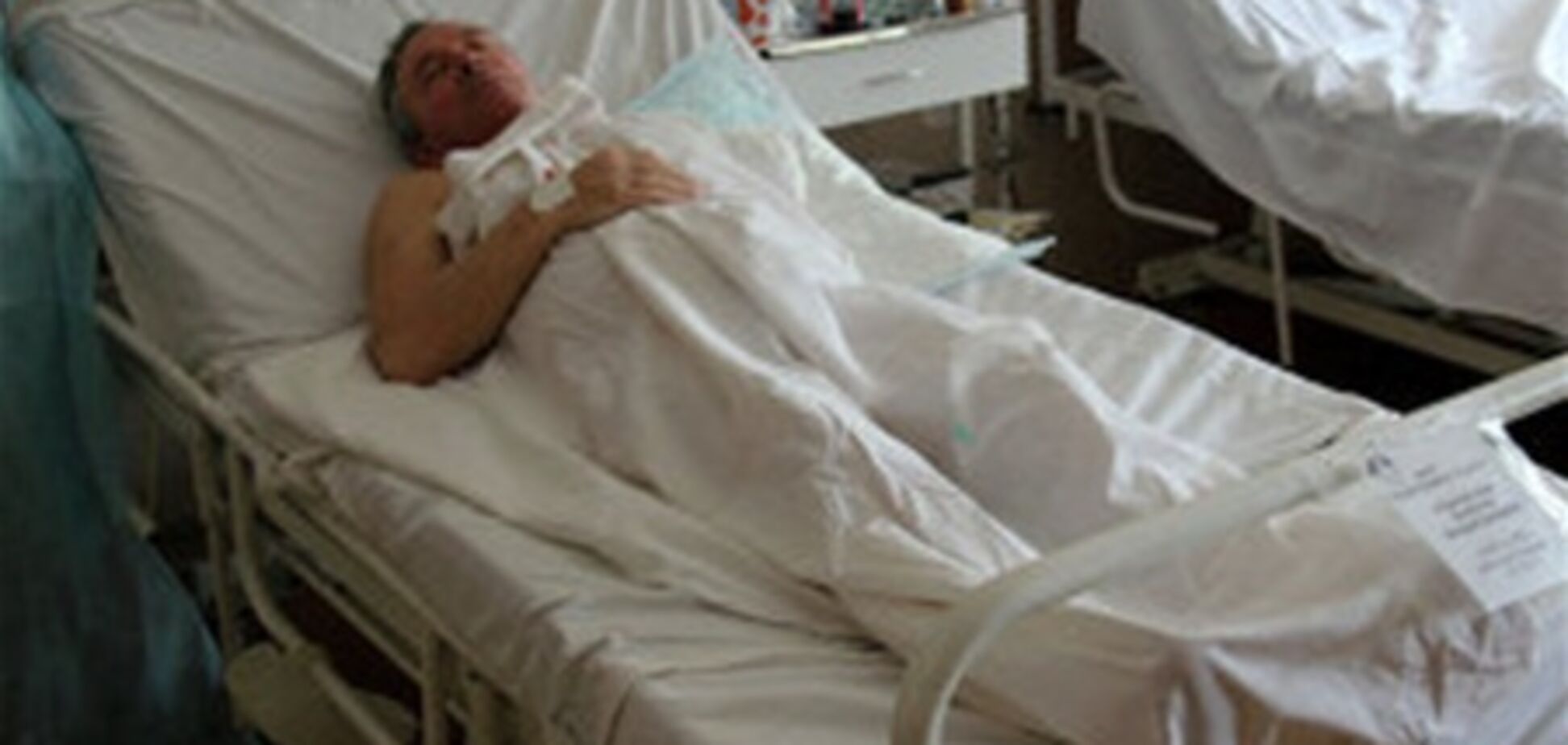 В больницах Днепропетровска остаются 14 пострадавших от взрывов