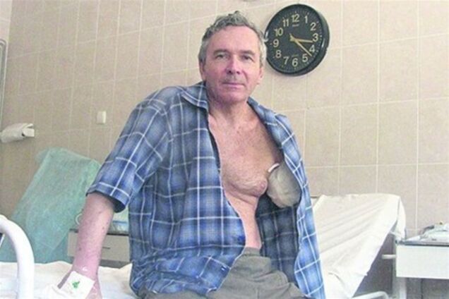 Жертве взрыва в Днепропетровске сделают электронную руку