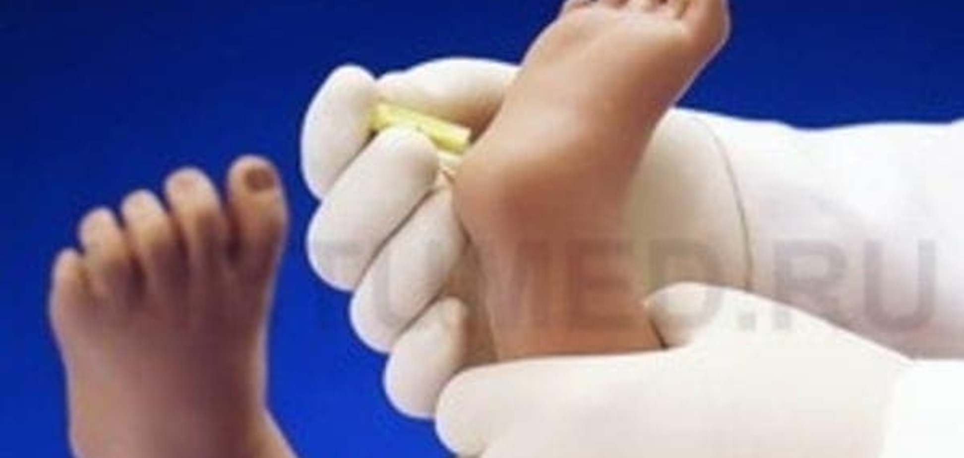 Неонатальный скрининг или зачем в роддоме берут кровь из пяточки