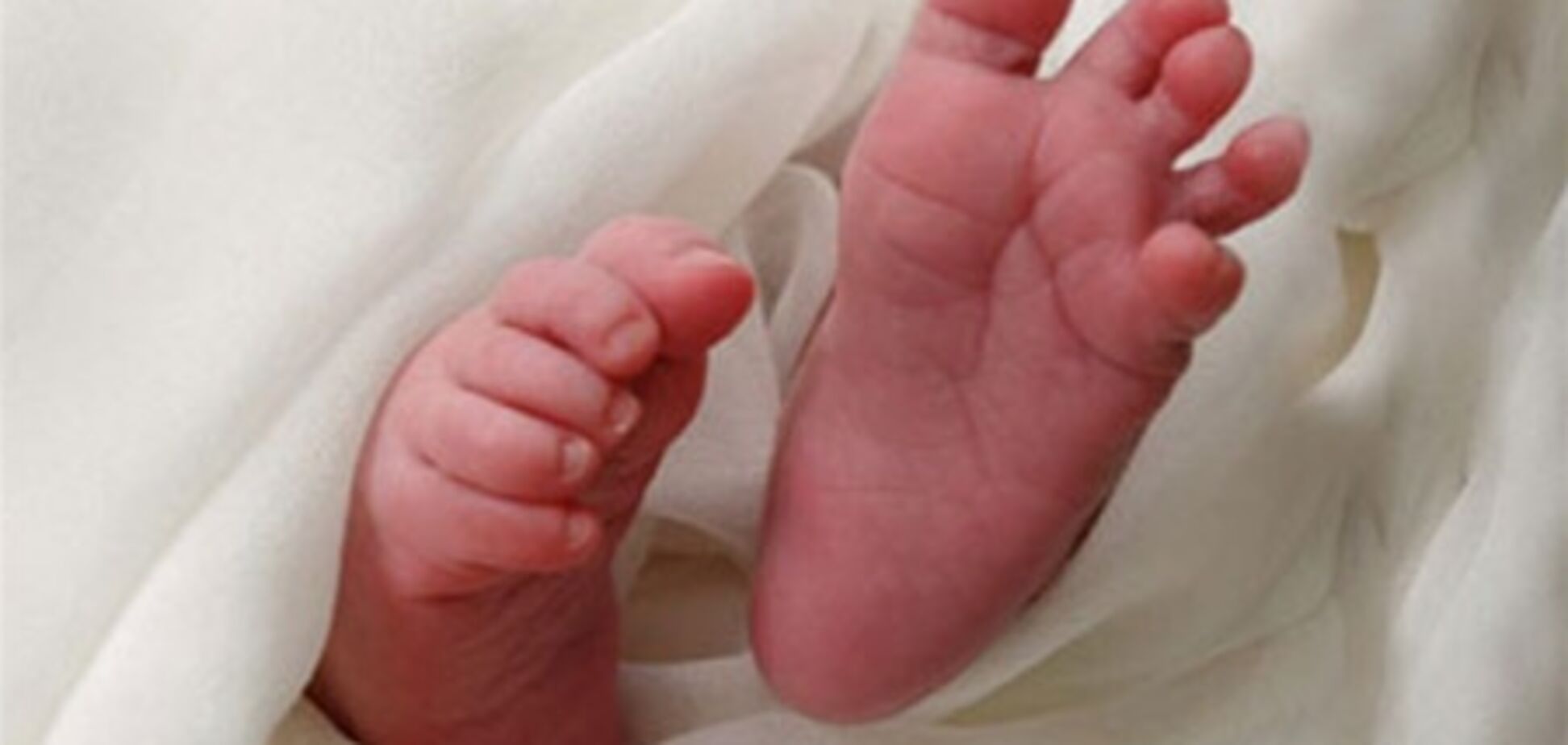 На Донетчине родились сиамские близнецы с одной печенью