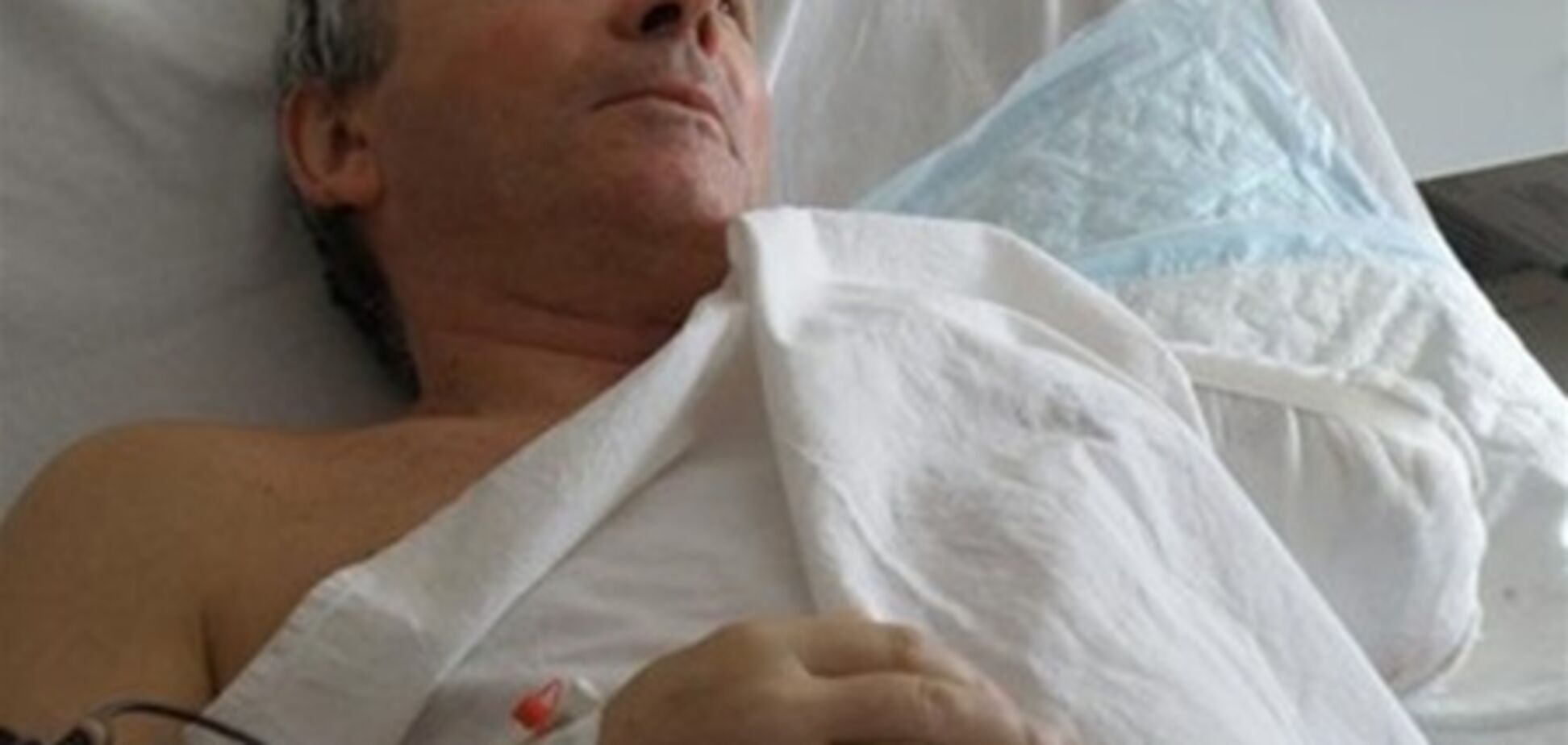 У лікарнях Дніпропетровська залишаються 14 постраждалих при вибухах