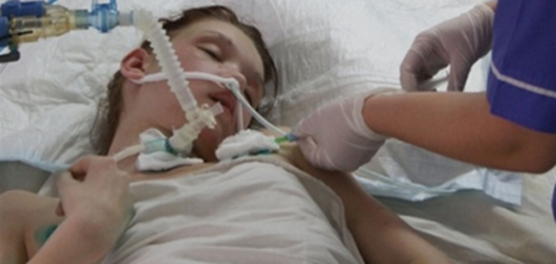 Саше Поповой нужно срочное лечение за границей