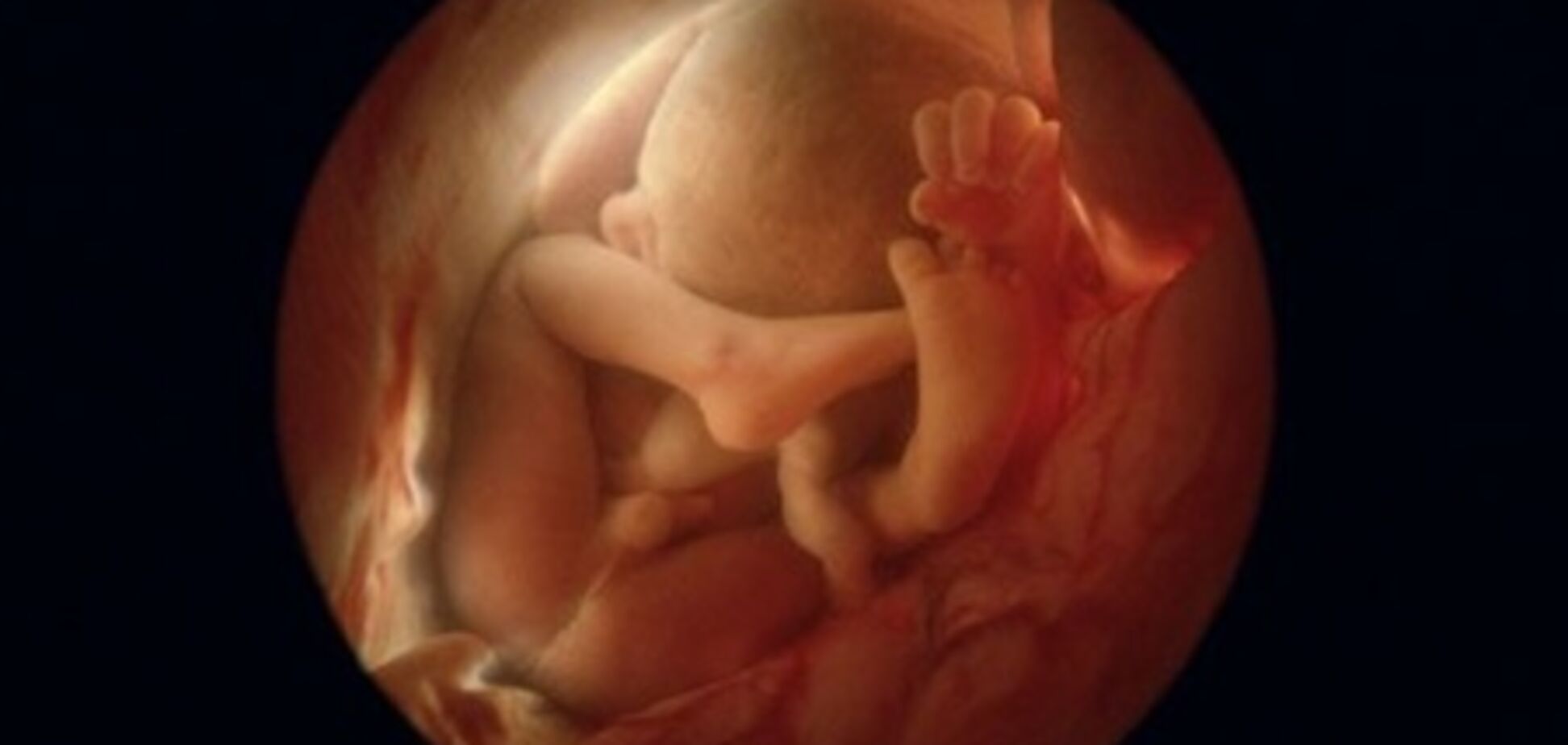 Абортарии всех стран, объединяйтесь?