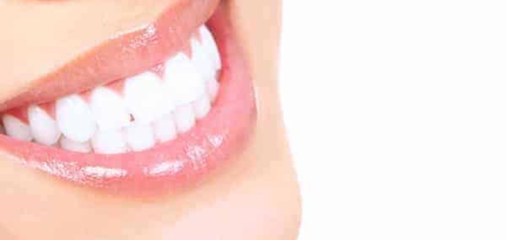 Косметическая стоматология или секрет голливудской улыбки