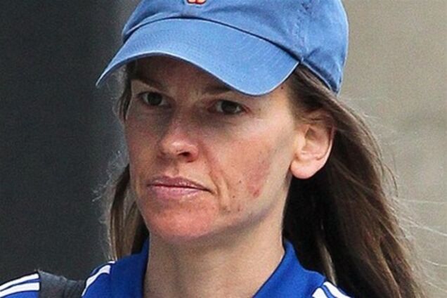 И у голливудских красоток бывает все лицо в прыщах