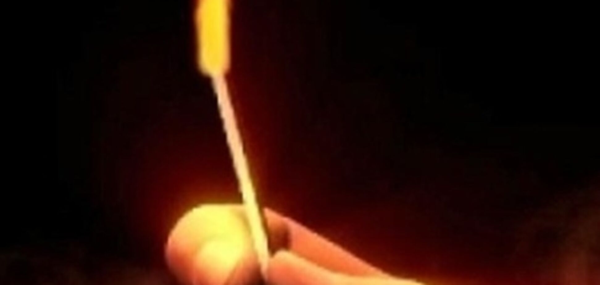 Возбуждено дело по факту получения ожогов 12-летним мальчиком