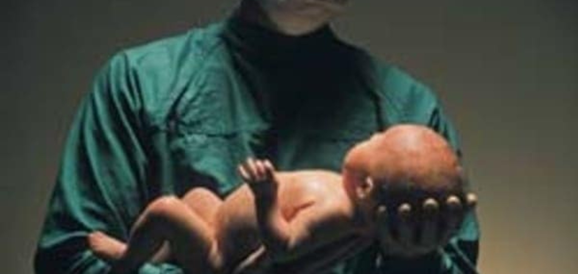 Осложнения в родах. Щипцы и вакуум-экстракция