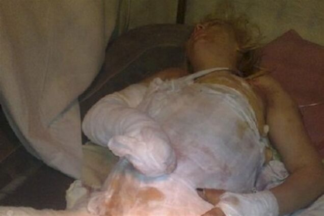 Врач: Оксана Макар тлела минимум 2-3 часа