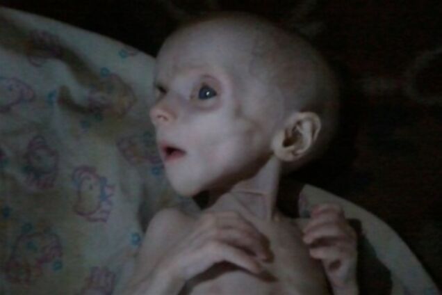 У Донецьку батьки до смерті заморили голодом дитини