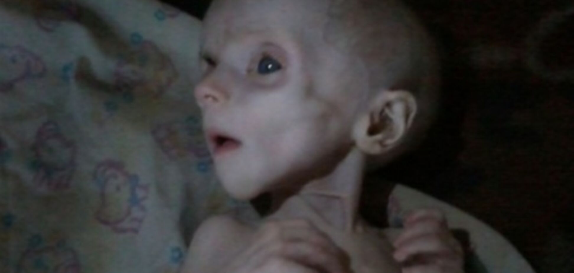 В Донецке родители до смерти заморили голодом ребенка