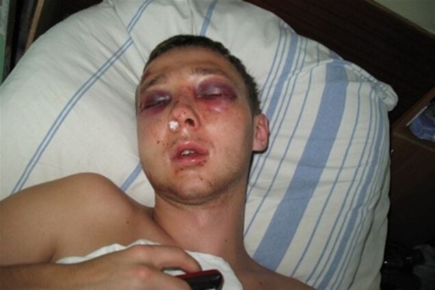 Міліціонер, який побив миколаївського студента, ходить на роботу