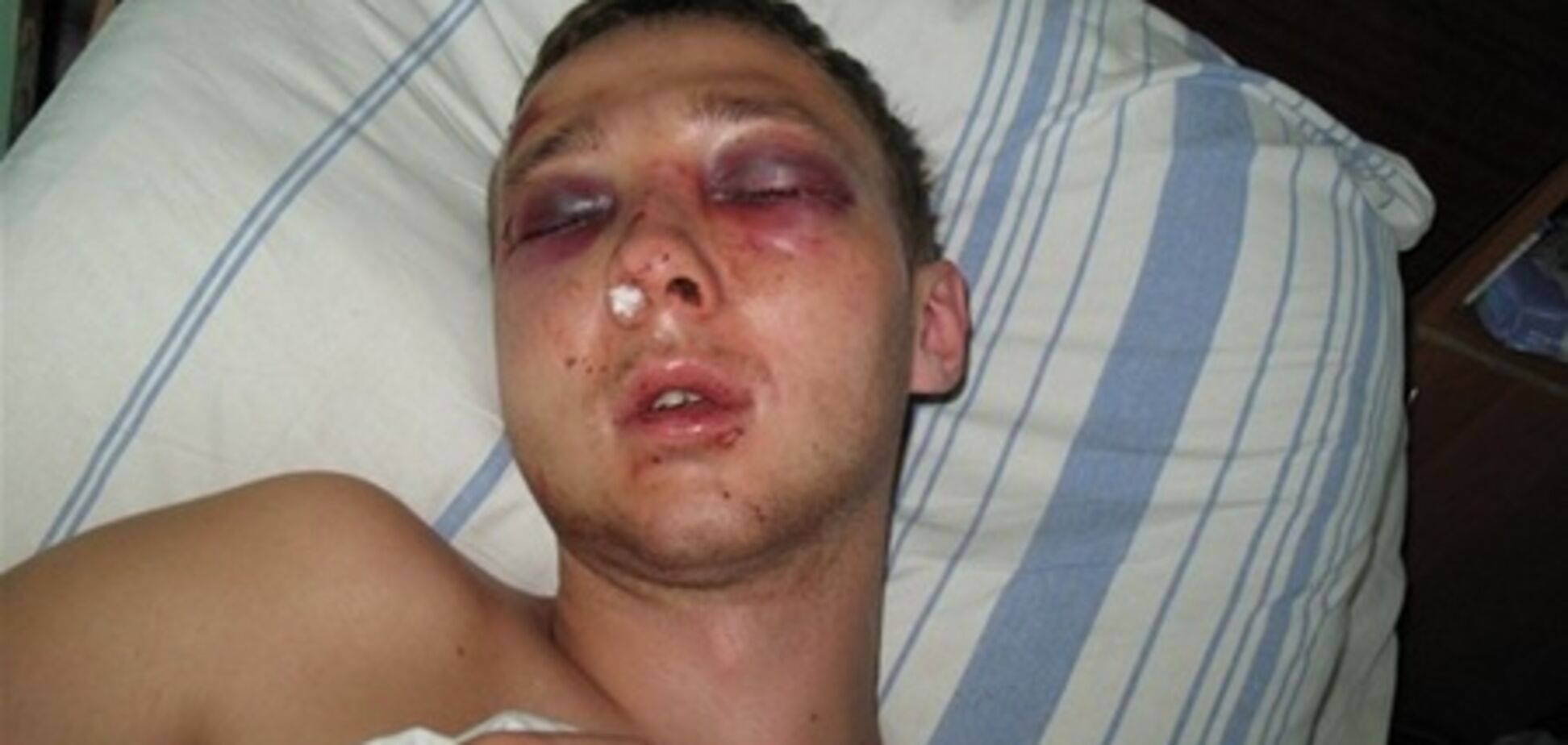 Милиционер, избивший николаевского студента, ходит на работу