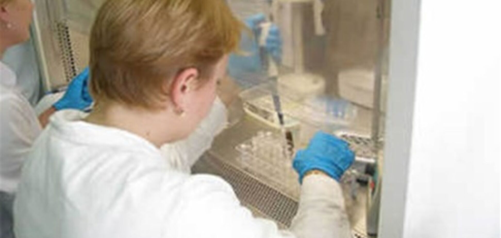 Обережно інфекція! Киян заражають гепатитом С