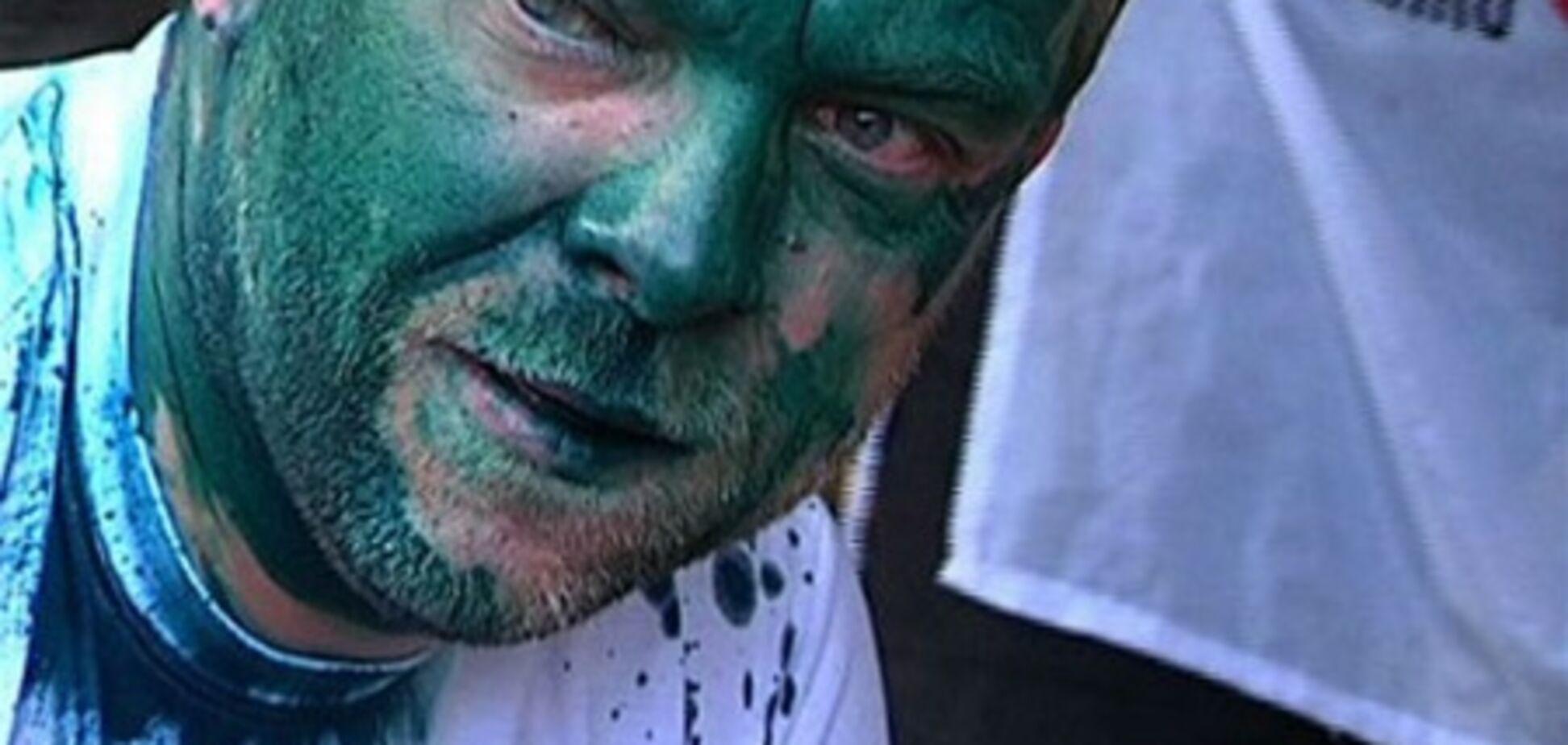 Из-за зеленки, вылитой на Власенко, заведено уголовное дело