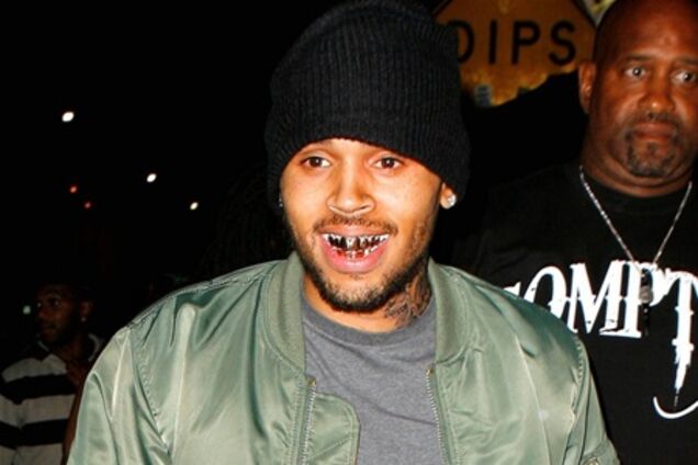 Крис Браун украсил свои зубы. Фото