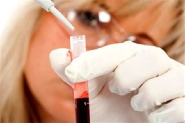 Люди з 4 групою крові більше за інших ризикують отримати інфаркт