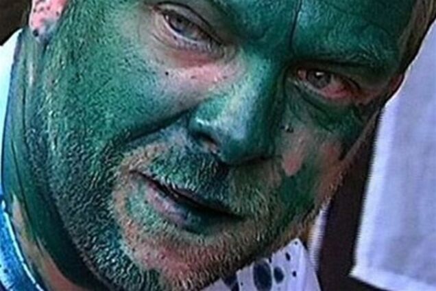 Власенко вновь облили зеленкой