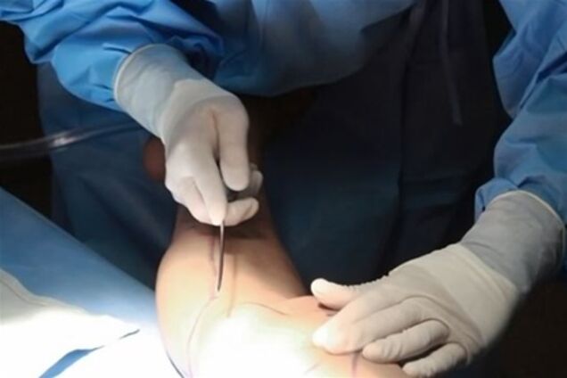 10 аргументов за и против липосакции