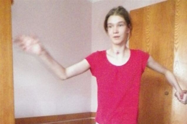 Саше Поповой прооперировали челюсть