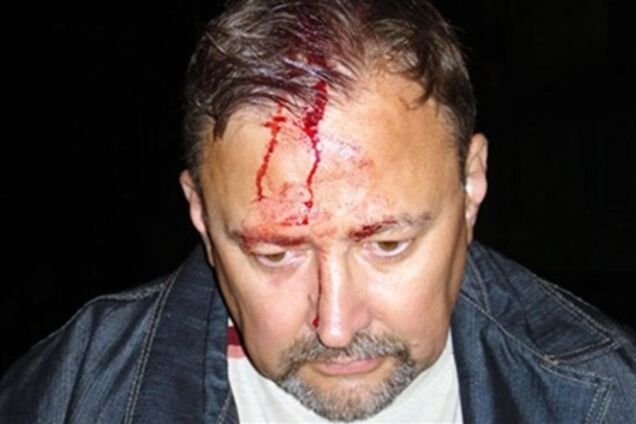 Нападение на главу штаба на Луганщине: милиция проводит проверку