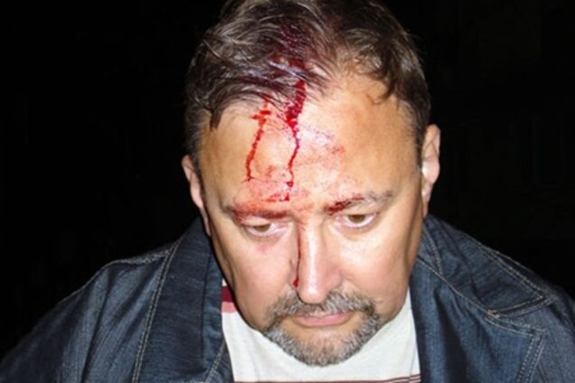 На Луганщине пытались убить главу штаба кандидата в нардепы