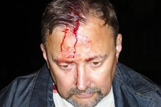 Нападение на главу штаба на Луганщине: возбуждено дело