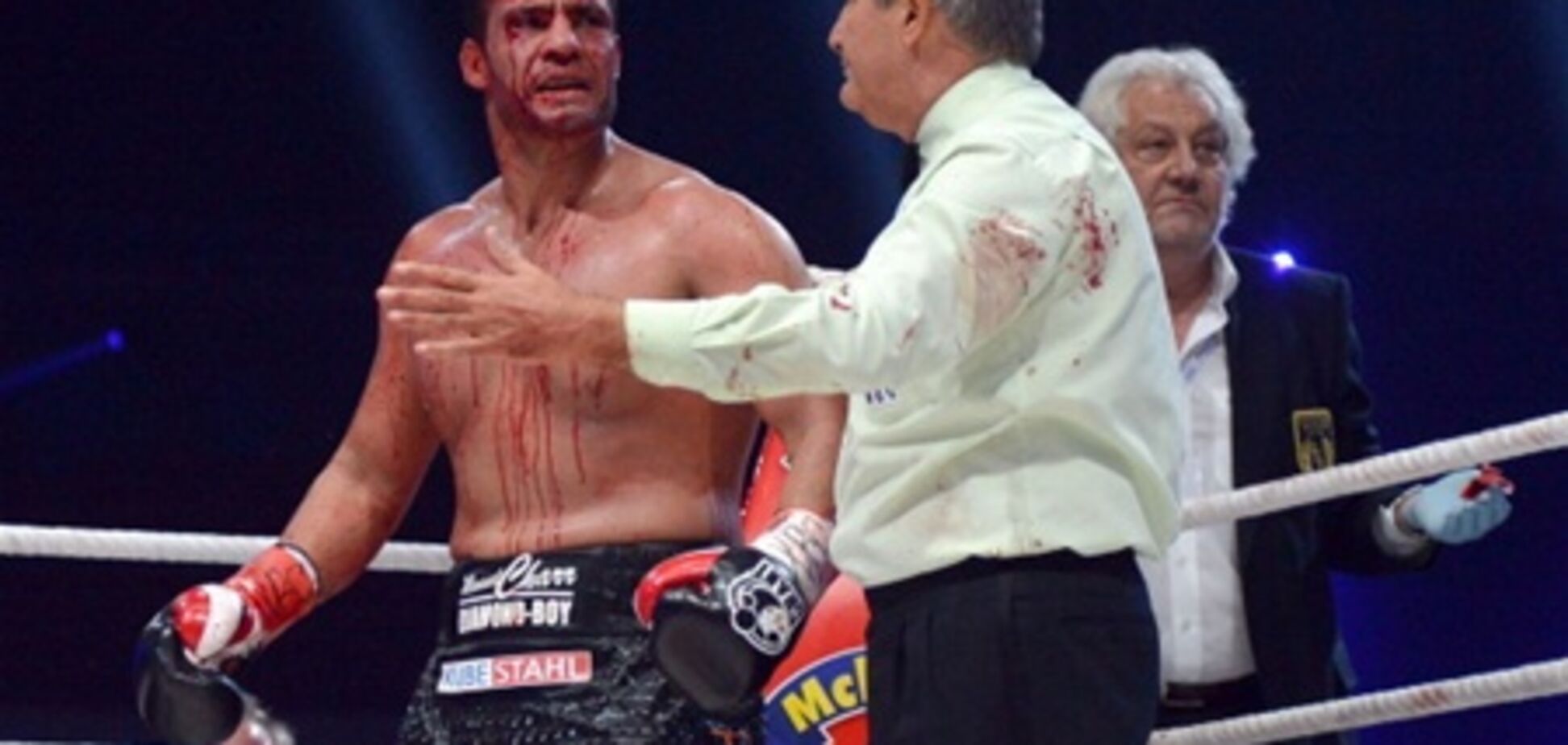 Как доктор Кличко пустил пациенту Чарру кровь. Фоторепортаж