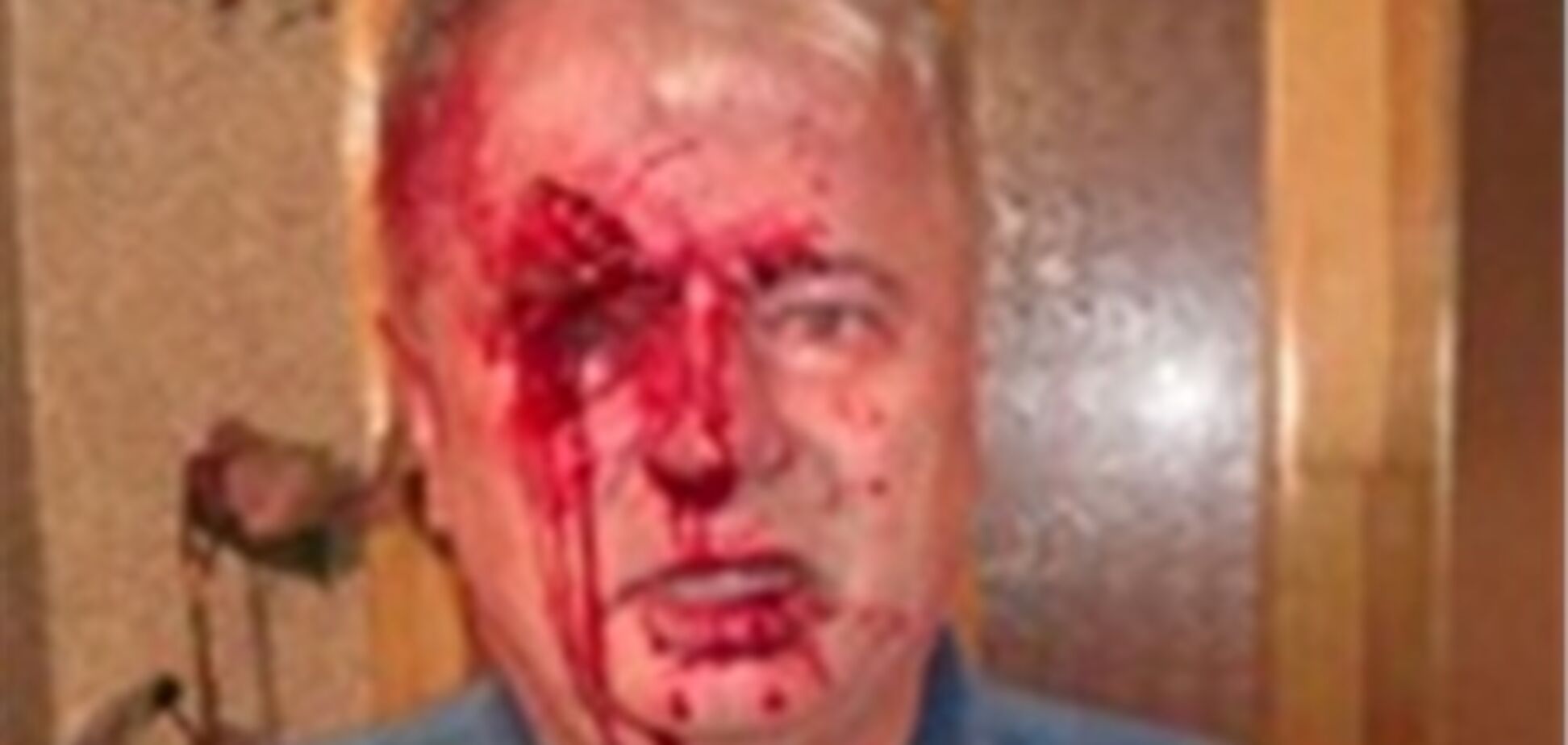 На Тернопольщине жестоко избили кандидата от 'Нашей Украины'