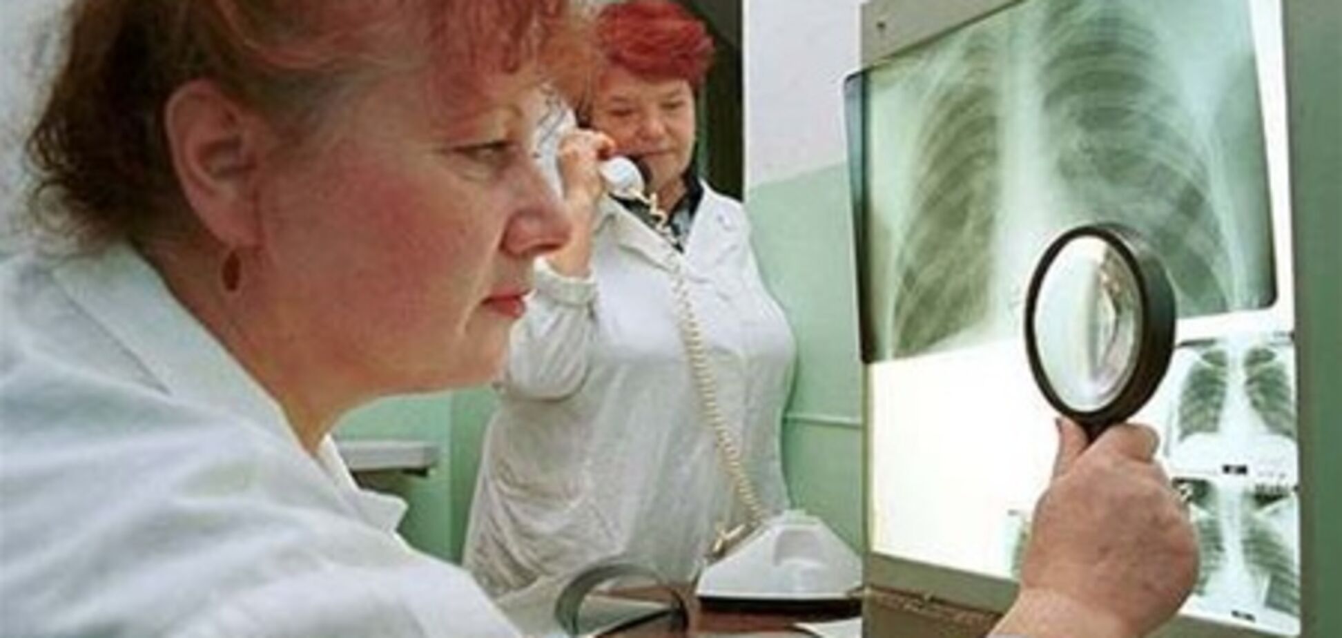 Отныне больных туберкулезом в Украине будут лечить принудительно