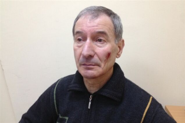 В Полтаве избили помощника нардепа от УДАРа. Фото