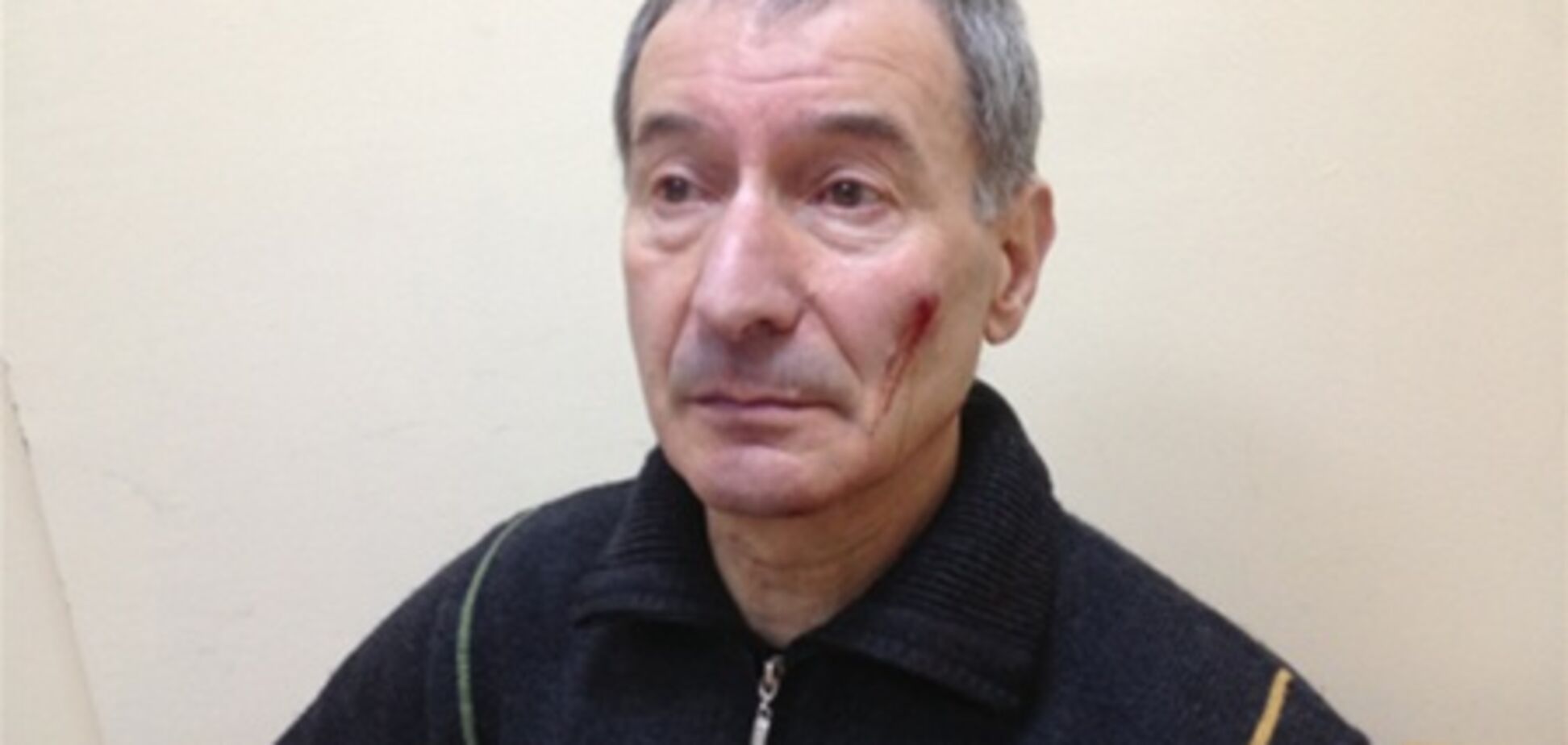 У Полтаві побили помічника нардепа від УДАРу. Фото