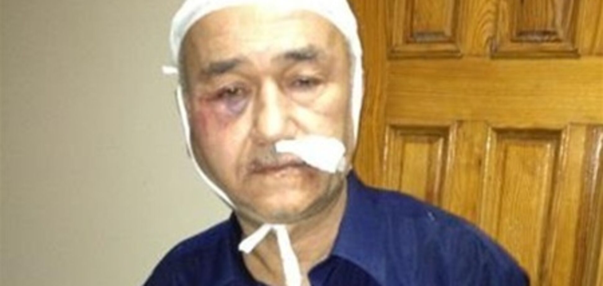 В Крыму совершено нападение на крымскотатарского активиста. Фото