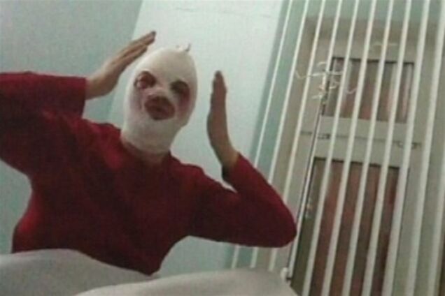 Худрук Большого простил напавшего на него с кислотой