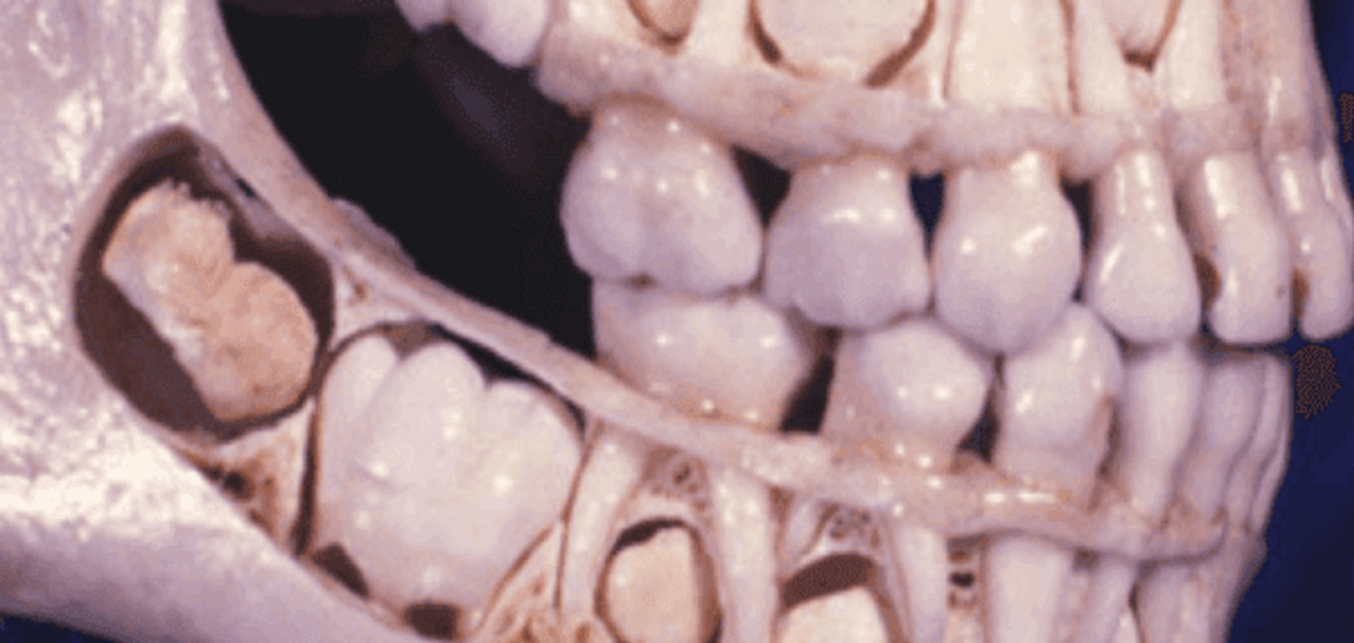 Чому догляд за молочними зубами є основою постійних здорових зубів?