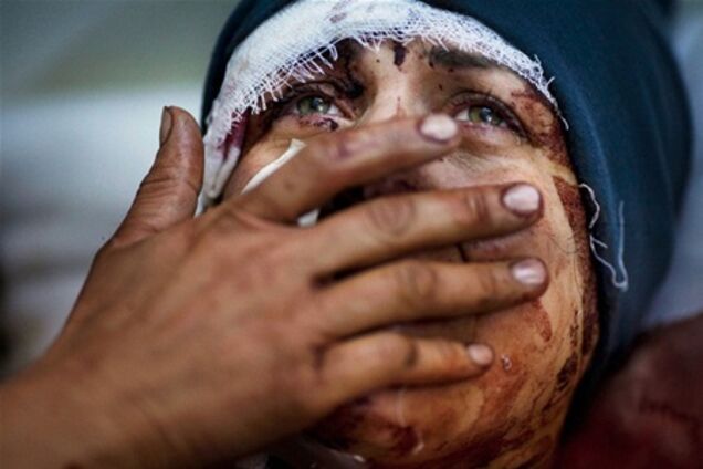 Правозахисники підрахували кількість жертв сирійського конфлікту