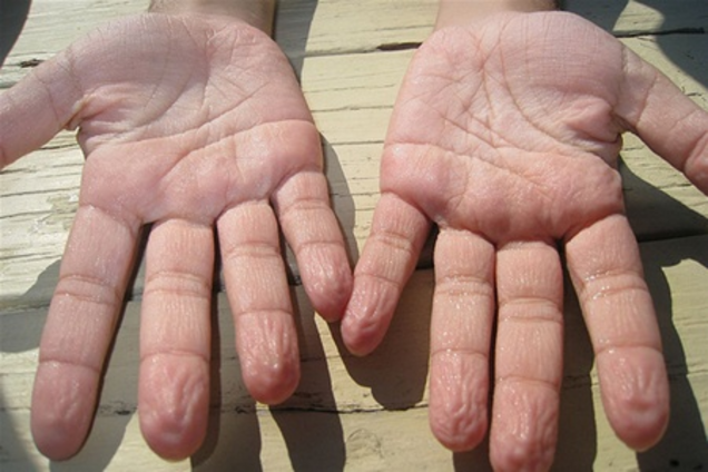 Ученые выяснили, почему наша кожа морщится от воды