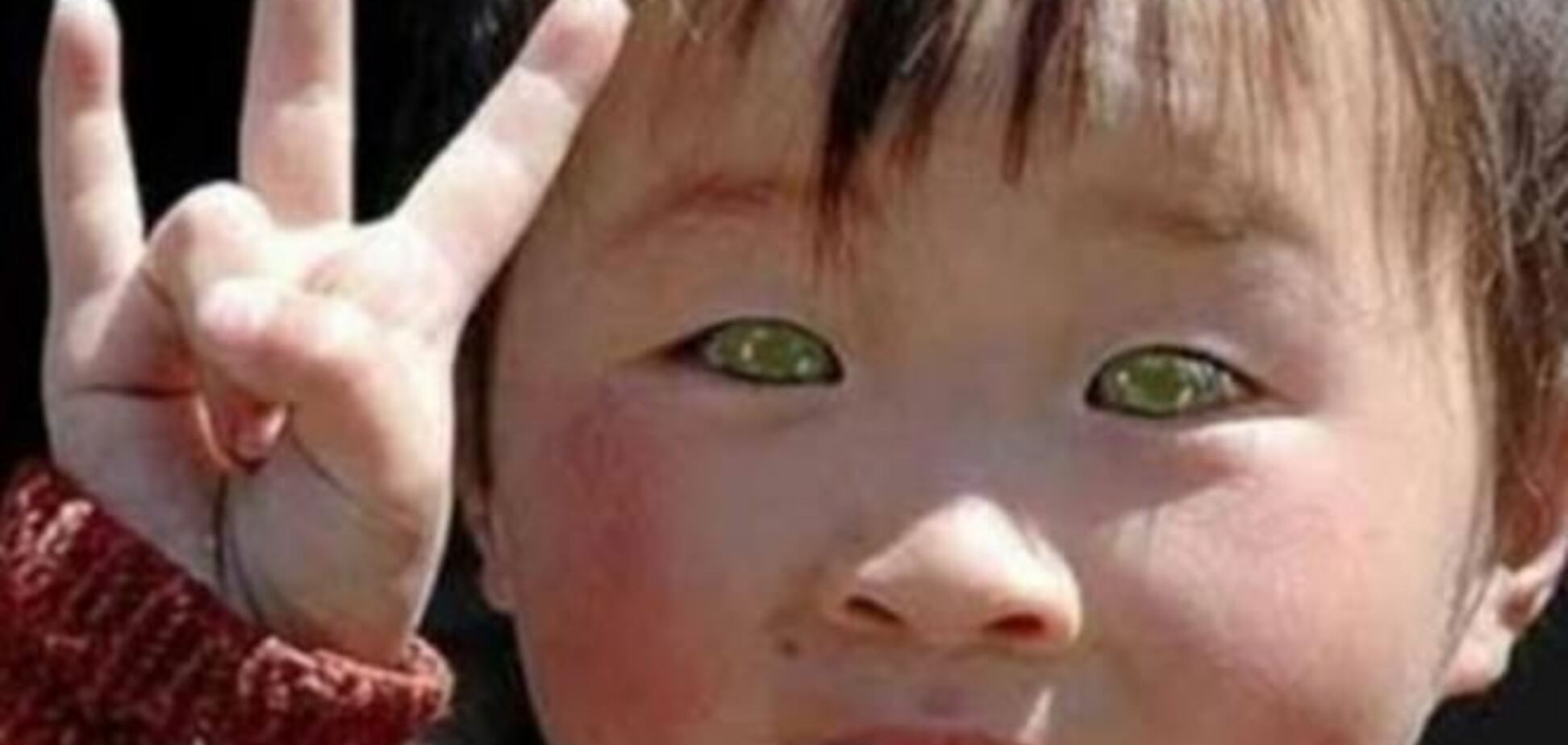 У Китаї живе дитина з котячими очима