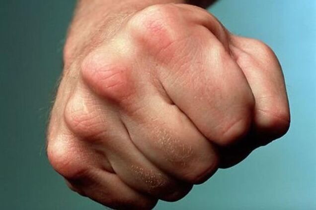 В Москве избили дипломата из Нидерландов – СМИ