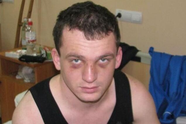 Охоронці львівського нічного клубу жорстокого побили бізнесмена