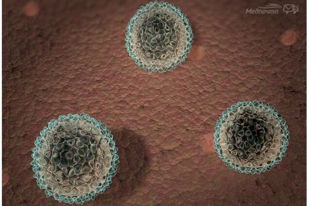 На Житомирщине 17 человек госпитализированы с гепатитом A