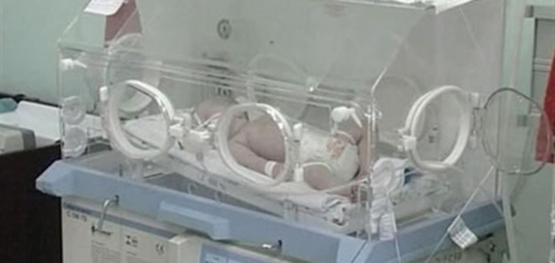 Младенец в Ужгороде впал в кому после тяжелых родов