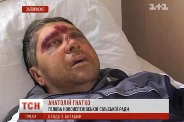 Милиция завела дело по факту бойни на дискотеке под Запорожьем