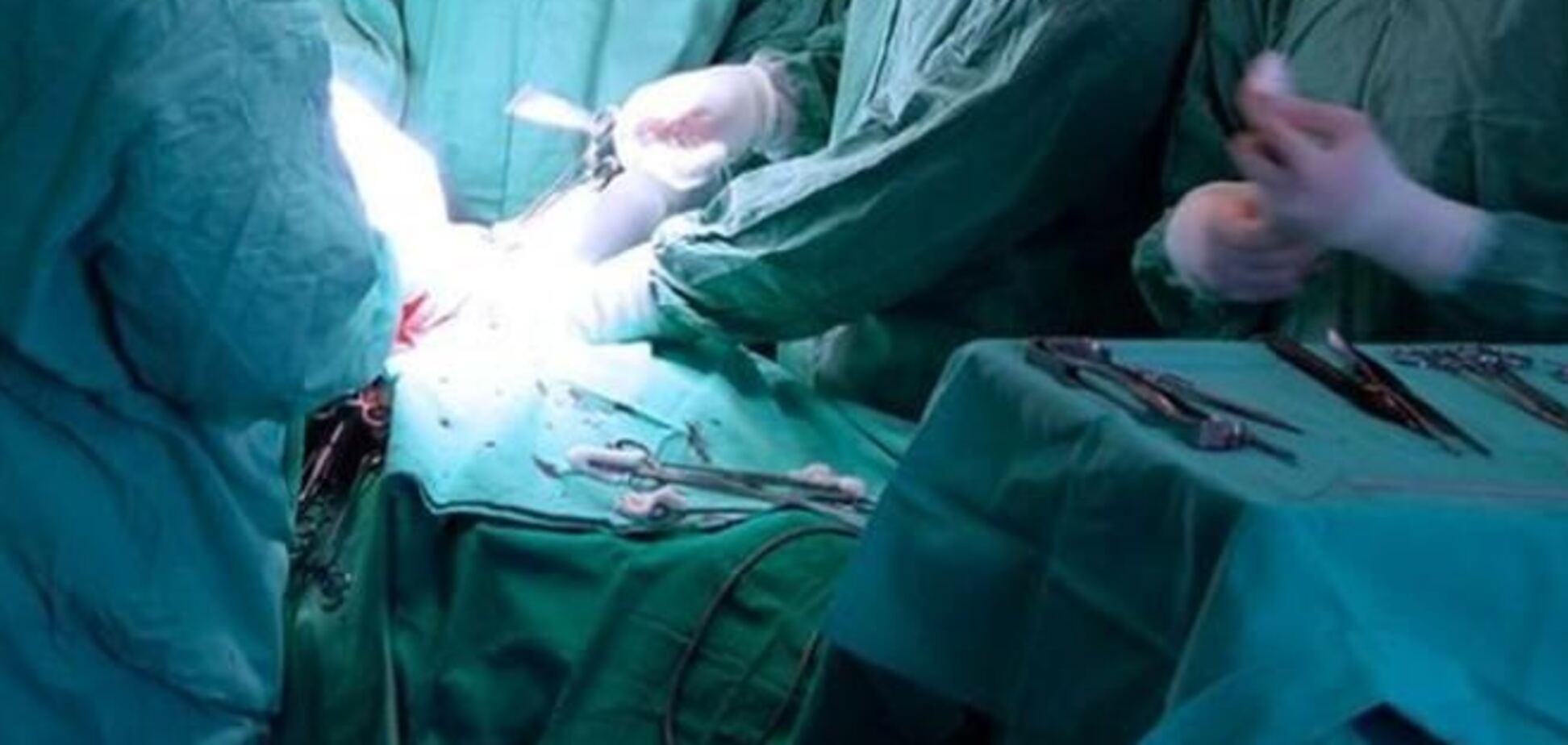 ВОЗ предложили заново использовать имплантаты умерших
