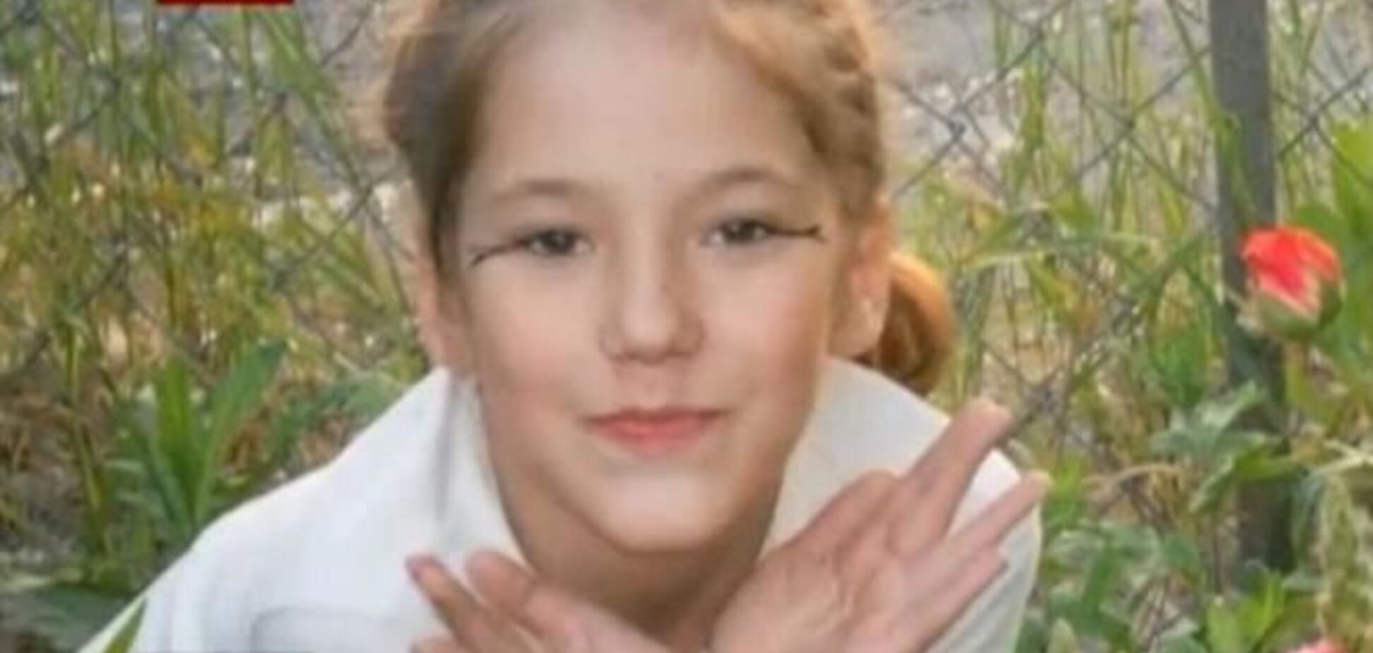 Пытаясь вывести вшей, жительница Одессы сожгла дочь