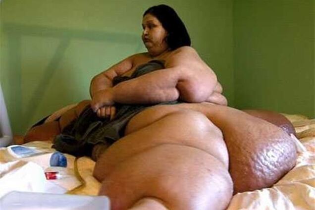 Женщина весом в полтонны показала свое новое тело